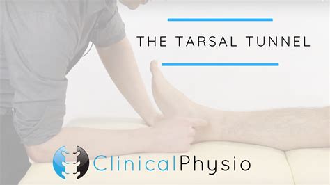 tarsal tunnel compression test|tarsal tunnel surgery recovery time.